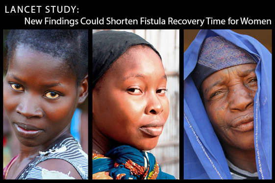 Lancet Study: New Findings Could Shorten Fistula Recovery Time for Women. Portraits of three women.