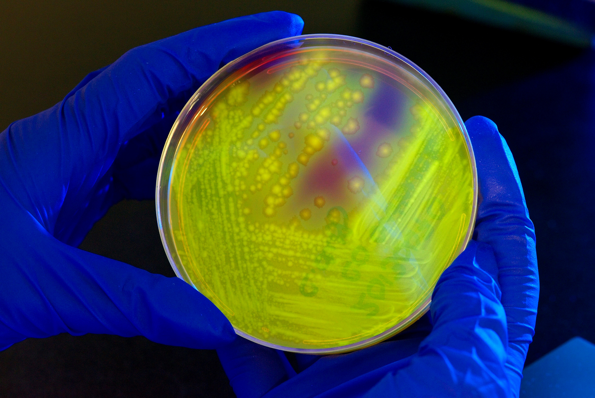 Antiobiotic Resistant Germs