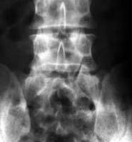 x ray
