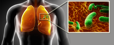 Lungs-TB Med pic