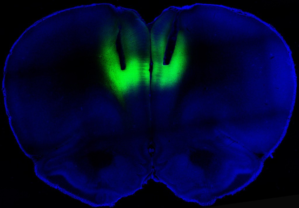 Optogenetic stimulation using laser pulses lights up the prelimbic cortex