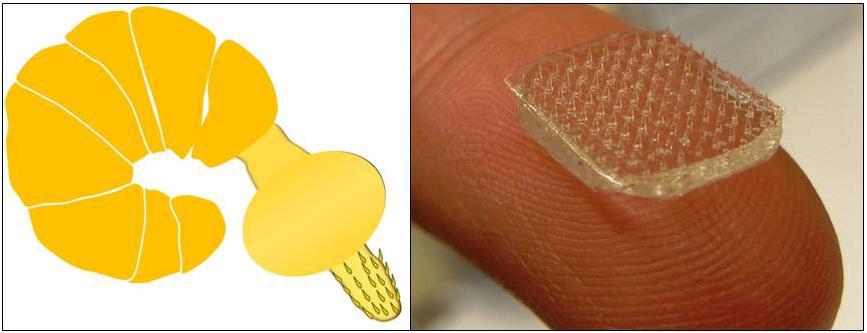 Artist rendition of spiny headed worm │The adhesive patch with microneedles that swellSource: The Karp Lab, Brigham and Women’s Hospital