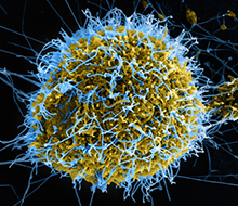 Microscopic image of Ebola virus particles budding from an infected cell.