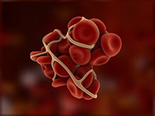 An illustration of a blood clot.