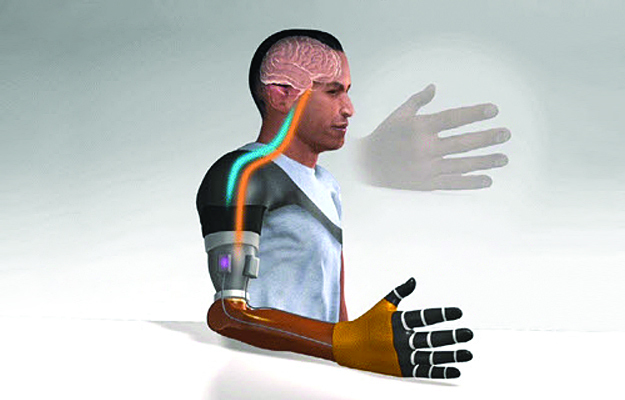 An illustration of a bionic prosthetic hand.