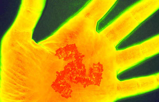 An image of a scan of a hand undergoing inflammation.
