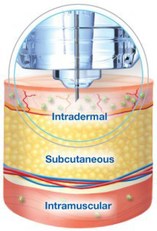 intradermal