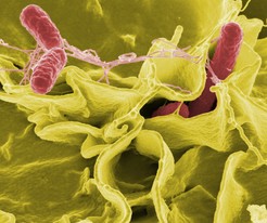 Microscopic view of a salmonella bacteria