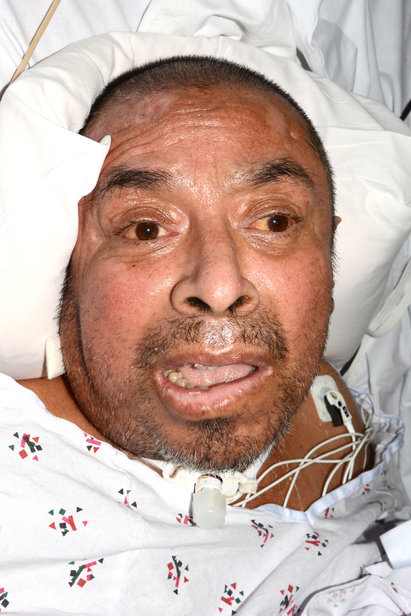 Photo of man with missing identity at LAC+USC Medical Center