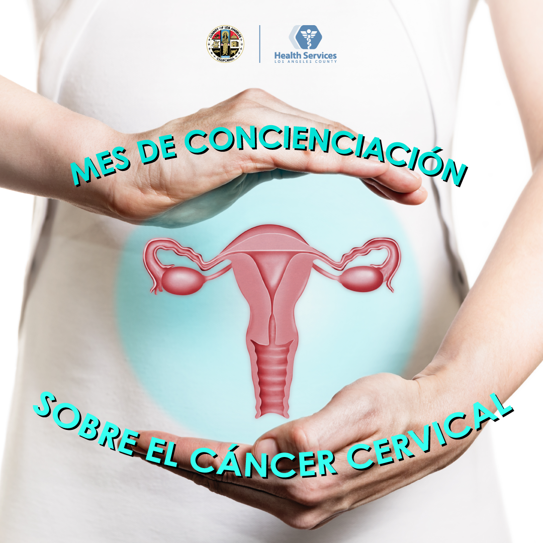 Cancer de Uterino