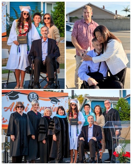 HBGrad