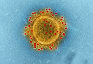 Virus under microscope