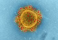 virus under microscope