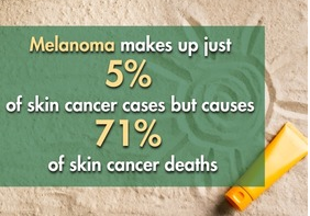 Melanoma