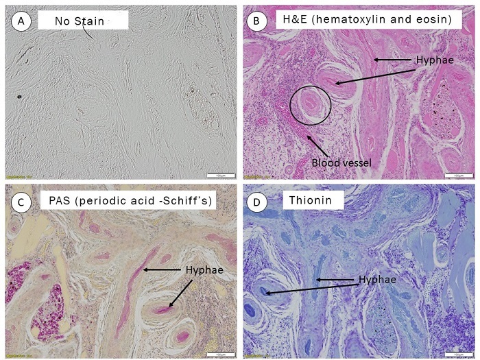 histology slides