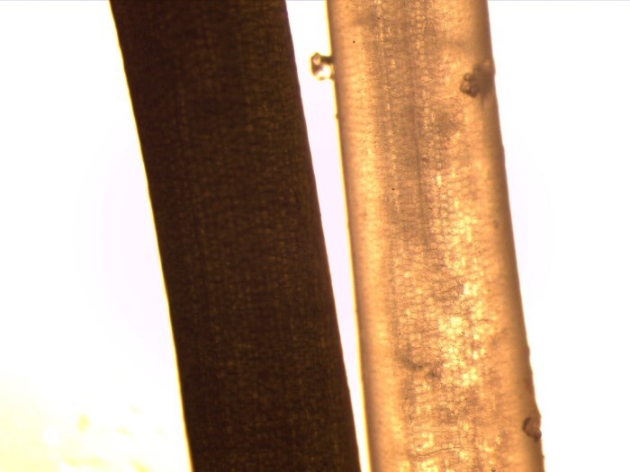 seagrass under microscope