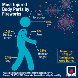 Fireworks Injuries