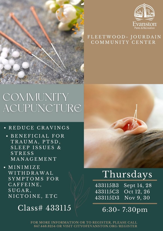 Community Acupuncture 