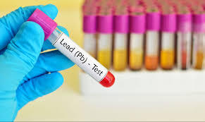 Lead Testing