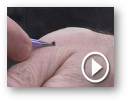 Tick removal video with shadow