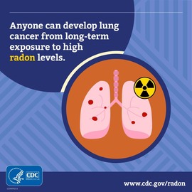 Radon lung 