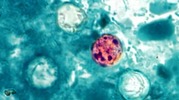 Graphical Image of the Microscopic Cyclospora Parasite in Red Surrounded by Healthy Cells in Blue