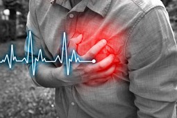 Heart attack