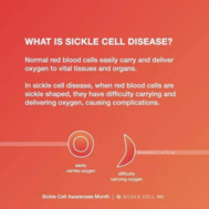sickle cell association 