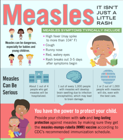measles