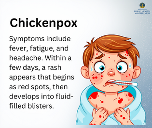 Chickenpox: Still Here, Still Preventable
