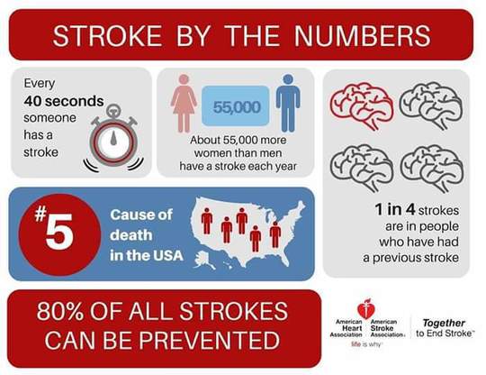 Stroke Infographic