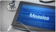 measles