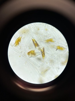 Enlarged didymo cells and stems