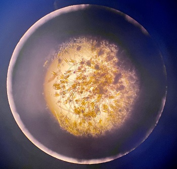 A magnified petri dish showing a mass of bottle-shaped didymo cells with long stalks protruding from the tops.