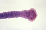 parasites