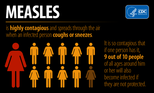 measles contagious