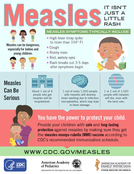 Measles English