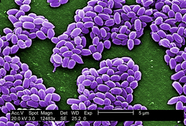 Microscopic view of Anthrax