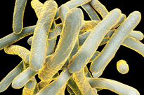 Microscopic illustration of tuberculosis bacteria