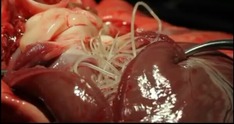 Heartworm infection