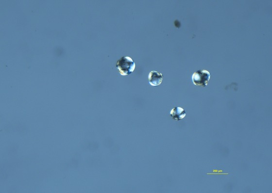 A zebra mussel veliger