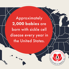 Approx. 2000 babies are born with sickle cell every year in the U.S.