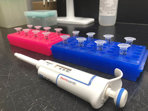 COVID-19 vials wastewater testing