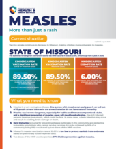 measles-fact-sheet