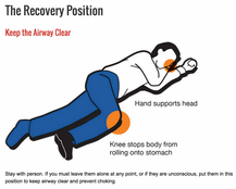 Recovery Position