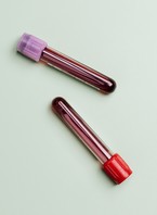 Two vials of blood