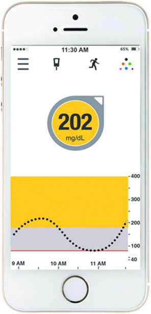 Image of a phone screen with CGM readings