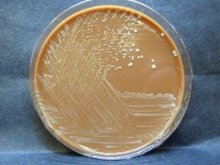 Slow growing bacteria 