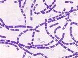 Large gram-positive rods