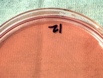 Slow growing on MacConkey